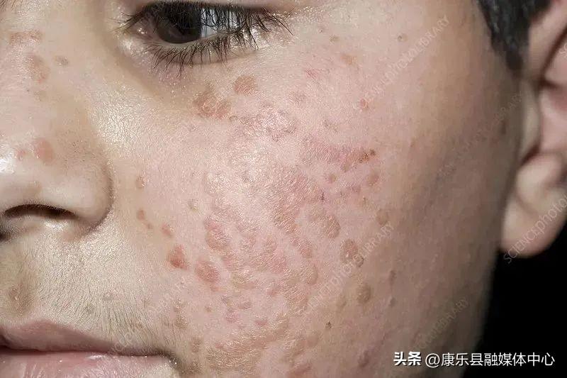 第326页